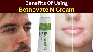 Betnovate n cream Review  betnovate n cream 20 grams  Benefits  how to use [upl. by Morton]