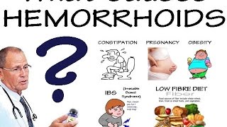 What causes hemorrhoids [upl. by Missak796]