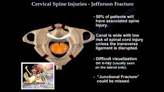 Jefferson Fracture  Everything You Need To Know  Dr Nabil Ebraheim [upl. by Brink]