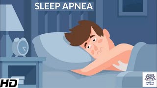 Sleep Apnea CausesSigns and Symptoms DIagnosis and Treatment [upl. by Anowahs]