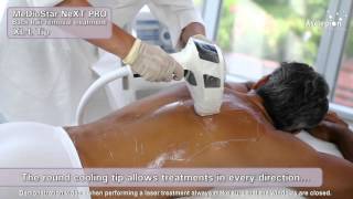 MeDioStar NeXT PRO XL  Training video for hair removal with SMOOTHPULSE mode from Asclepion [upl. by Egamlat]