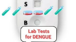 What are LAB TESTS in Dengue [upl. by Notsnarc]