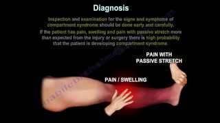 Compartment SyndromeDiagnosisPressuresFasciotomy Everything You Need To Know Dr Nabil Ebraheim [upl. by Arratoon]