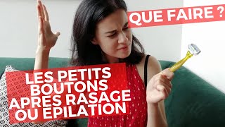 Ne plus avoir les boutons rouges après rasage ou épilation [upl. by Aniraz]