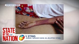 State of the Nation Nasawi dahil sa Jelly Sting Tip Talk Mga dapat gawin kapag nakapitan ng dikya [upl. by Yemane]