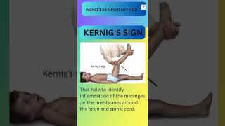 Kernigs Sign Norcet 08 Image Base Question ytshorts [upl. by Eidob277]