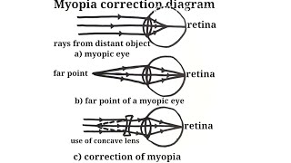 Myopia correction diagram  how to draw myopia correction diagram  myopic eye diagram  science dia [upl. by Ramsdell29]