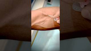 Mastering Canalization A StepbyStep Guide to Expert IV Catheterization highlight toptrending [upl. by Aryaz752]