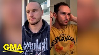 TikTok influencer who started losing hair at 19 breaks stigma around male hair loss l GMA [upl. by Ham]