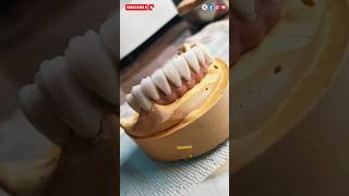 Anterior ceramic crown trending viralvideo hamidraza01 ideal2 dental lab Pune [upl. by Nnahteb]