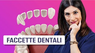 Faccette dentali [upl. by Conall]