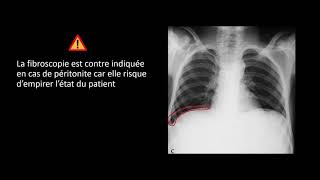 Sémiologie Digestive  Signes Fonctionnels 1 [upl. by Maynard827]