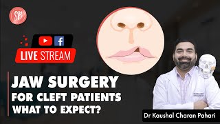 Jaw surgery in Cleft Patient  Cleft Lip amp Palate Treatment  SB Aesthetics [upl. by Pegeen]