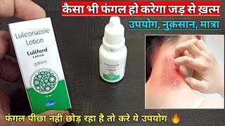 Fungal infection को करे जड़ से ख़त्म  Luliconazole Lotion Review🔥🔥🔥MedicalJankari [upl. by Hutchison171]