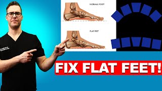 How To FIX Flat Feet 16 BEST Home Remedies Shoes amp Arch Insoles [upl. by Aeniah]