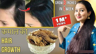 30 Days Extreme Hair Growth Challenge  कितने भी झड़ चुके हों बाल इस रेमेडी से होगी कमाल की Growth [upl. by Doll887]