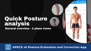 Quick Posture analysis  APECS short demonstration [upl. by Ailis]