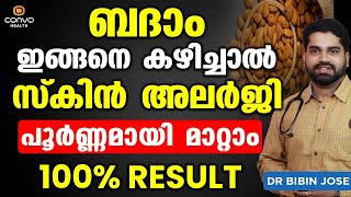 ബദാം ഇങ്ങനെ കഴിച്ചാൽ സ്കിൻ അലർജി പൂർണ്ണമായി മാറ്റാം  Allergy Treatment at Home Dr Bibin Jose [upl. by Aanas]