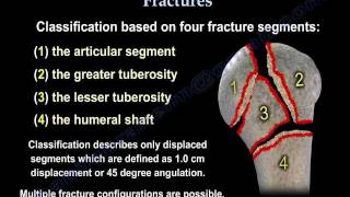 Proximal Humerus Fractures classification  Everything You Need To Know  Dr Nabil Ebraheim [upl. by Yren]