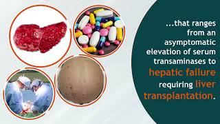 Management of Antitubercular Druginduced Hepatoxicity [upl. by Eon]