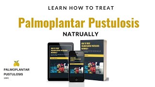 How To Treat Palmoplantar Pustulosis PPP Naturally [upl. by Nwahsyt322]