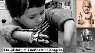 The TERRIFIC History of Thalidomide Tragedy [upl. by Eerual]