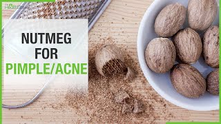 Nutmeg Benefits For Skin One Spice Solution To Treat Skin Problems Like Acne amp Pimple [upl. by Marv621]