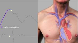 Easy Measurement of Jugular Venous Pressure [upl. by Ennailuj993]