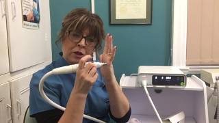 SWIFT MICROWAVE THERAPY VERRUCAE TREATMENT [upl. by Shannen427]