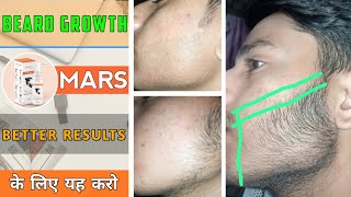 BEARD GROWTH □ Better results के लिए ये करो 🤫  Do this for better results  Mars by ghc [upl. by Sieber334]