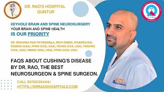 FAQs for the Cushings disease by expert Dr Rao [upl. by Senaj564]