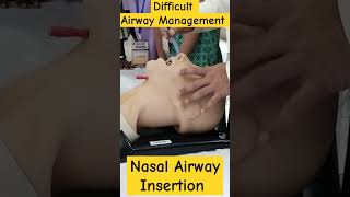 Nasopharyngeal Airway Insertion Technique nursingofficer hospital icunursing airwaymanagement [upl. by Seerdi]