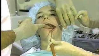 General Procedures in Oral Surgery [upl. by Pantia]