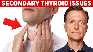 Most Thyroid Issues Are Secondary to Other Problems – Dr Berg [upl. by Anidal352]