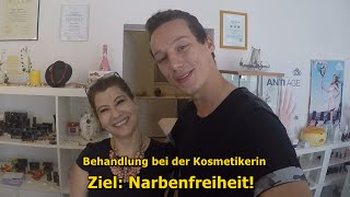 AKNEBehandlung bei der KOSMETIKERIN LIVE [upl. by Diane-Marie]