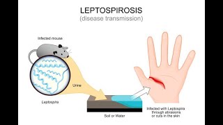 Understanding Leptospirosis Symptoms and Treatment  Expert Guide [upl. by Chuch]