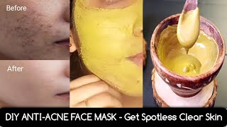 DIY Antiacne Face Mask  Erase all Acne Scars PimplesOpen pores amp Get Clear Spotless Glowing Skin [upl. by Rocker218]