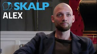 Alexs scalp micropigmentation testimonial with Skalp® [upl. by Asiak]