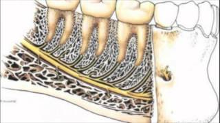 Rapports anatomiques de la troisième molaire mandibulaire [upl. by Zarihs]