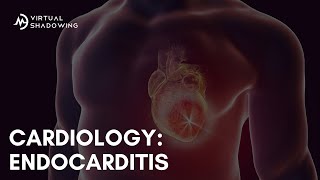 Virtual Shadowing Endocarditis [upl. by Clyde]