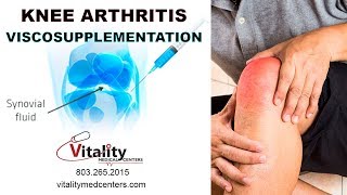 Knee Viscosupplementation Treatment for Osteoarthritis [upl. by Carrol]