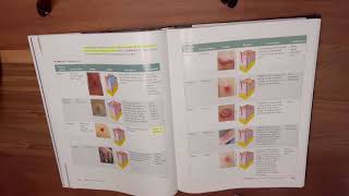 Milady Cima Standard Esthetics Chapter 4 Disorders and Diseases of the Skin [upl. by Oruam491]