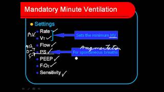 Mandatory Minute Ventilation MMV [upl. by Aldo247]