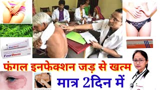 Fungal infection treatment by sp networkघरेलू और कम ख़र्च।। [upl. by Warder858]