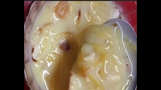 Easy sweet recipe Semiya custard 🍮 quick and simple recipe [upl. by Polinski484]