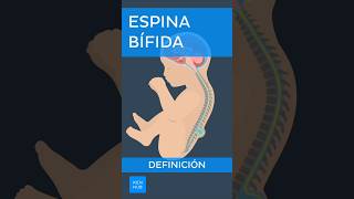 Espina bífida Definición  Kenhub espinabifida [upl. by Nemaj]