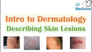 Introduction to Dermatology  The Basics  Describing Skin Lesions Primary amp Secondary Morphology [upl. by Ariat]