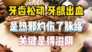 牙齿松动牙龈出血，是热邪灼伤了脉络，关键是得滋阴 [upl. by Nygem904]