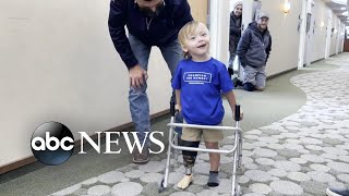 Paralympic medalist cheers toddler’s first steps with prosthetic leg  WNT [upl. by Alf918]