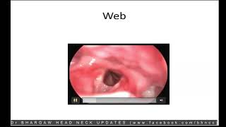 INTERPRETING THE LARYNGOSCOPY [upl. by Inacana520]